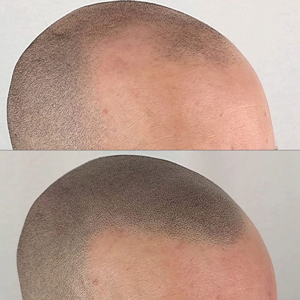 Smp dublin before after 6: smp dublin