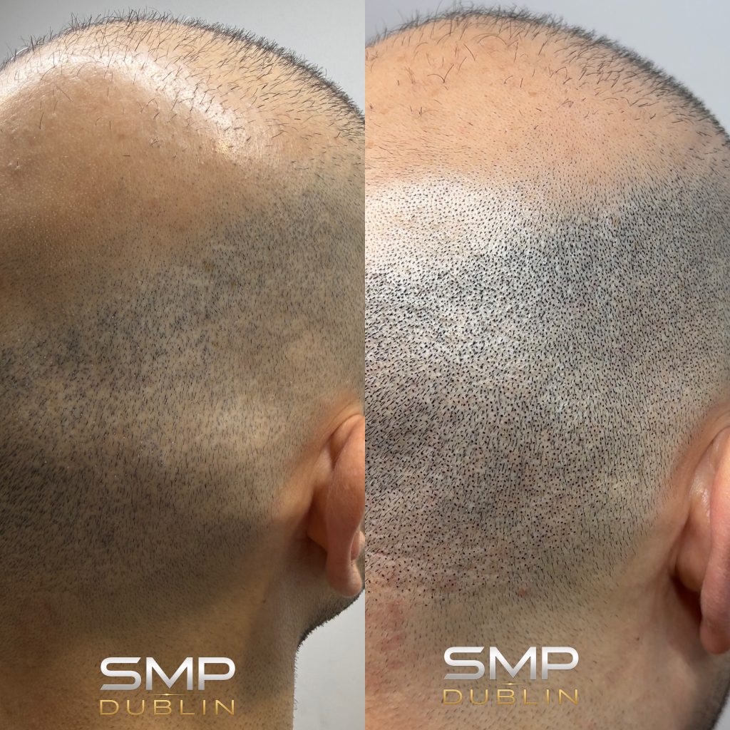 Scar camo when you click on 1st pic: smp dublin