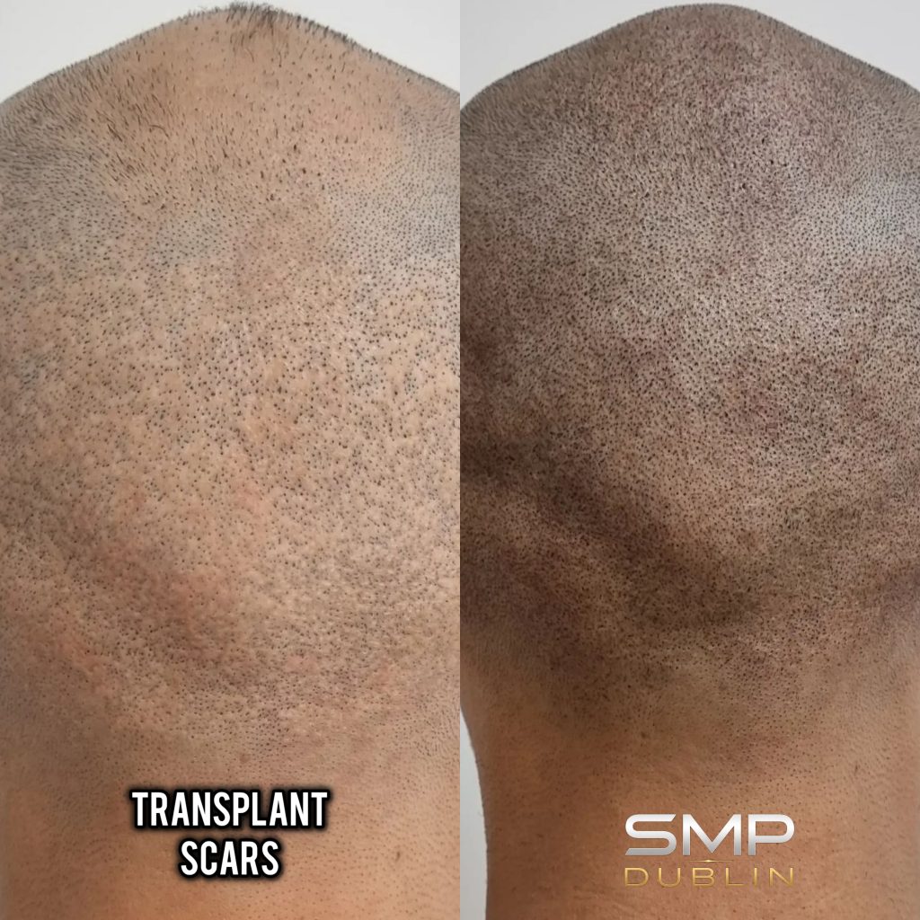 Scars main pic in square: smp dublin