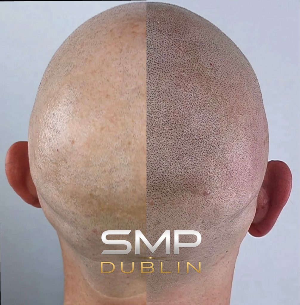 Whatsapp image 2026 05 06 at 22. 14. 31: smp dublin