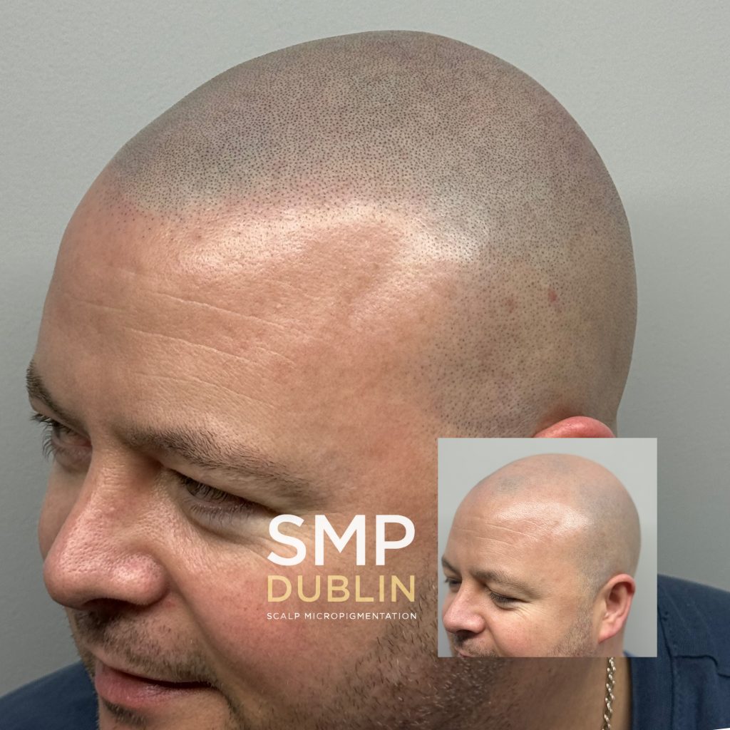 When you click on smp for men first pic: smp dublin