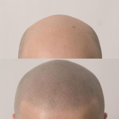 smp-dublin-before-after-1