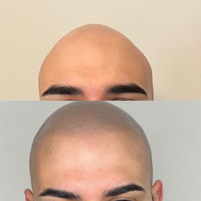 smp-dublin-before-after-10