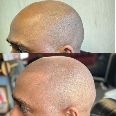 smp-dublin-before-after-11