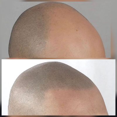 smp-dublin-before-after-15