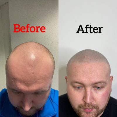 smp-dublin-before-after-2