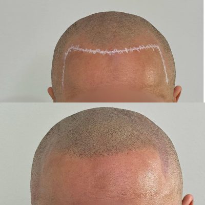 smp-dublin-before-after-3