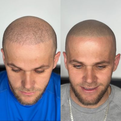smp-dublin-before-after-4