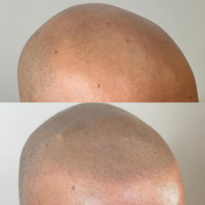 smp-dublin-before-after-5