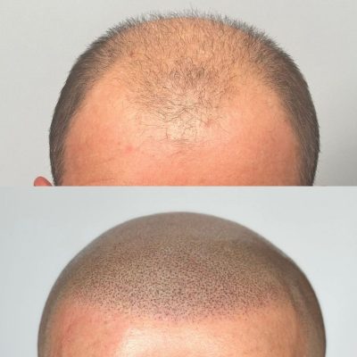 smp-dublin-before-after-7