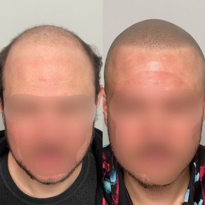 smp-dublin-before-after-8