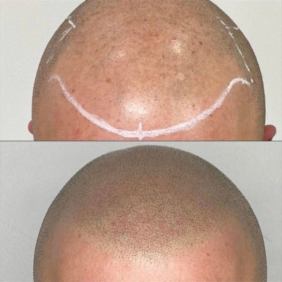 smp-dublin-before-after-9
